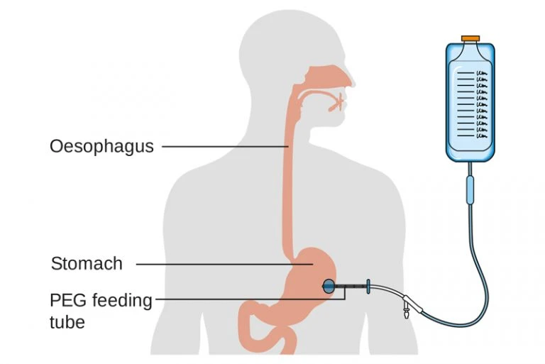 Hình ảnh thiết bị đang sử dụng