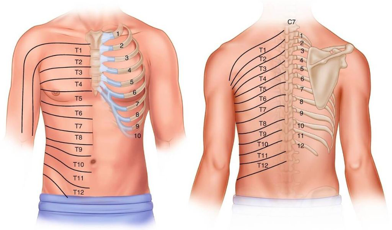 Cách chữa đau thần kinh liên sườn tại nhà hiệu quả, dễ thực hiện