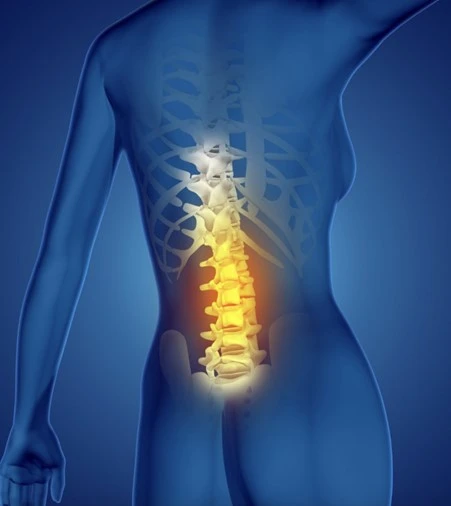 Điều trị thành công chứng thoát vị đĩa đệm đốt sống L4-L5 nhờ phương pháp Chiropractic