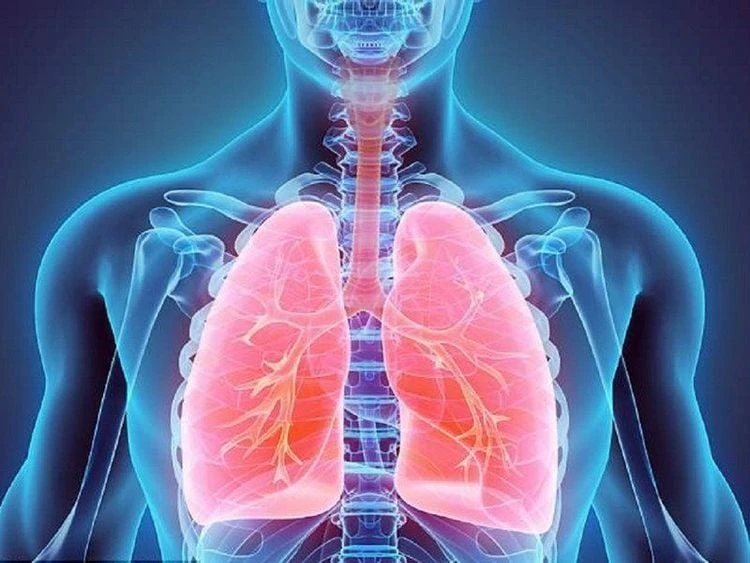 Cách điều trị viêm phế quản ở người lớn hiệu quả