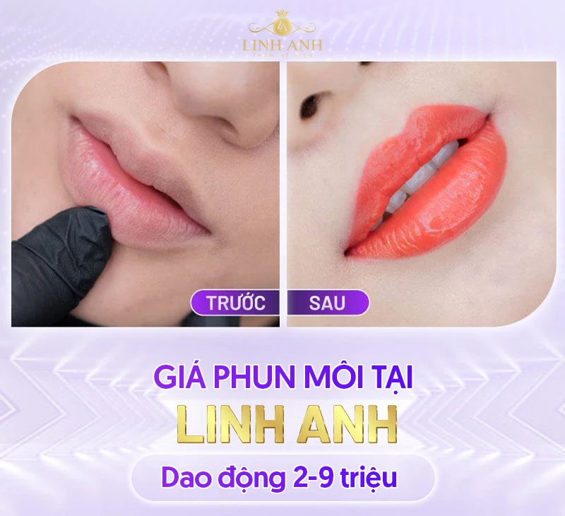 Bảng giá Thẩm mỹ viện Quốc tế Linh Anh cập nhật mới nhất