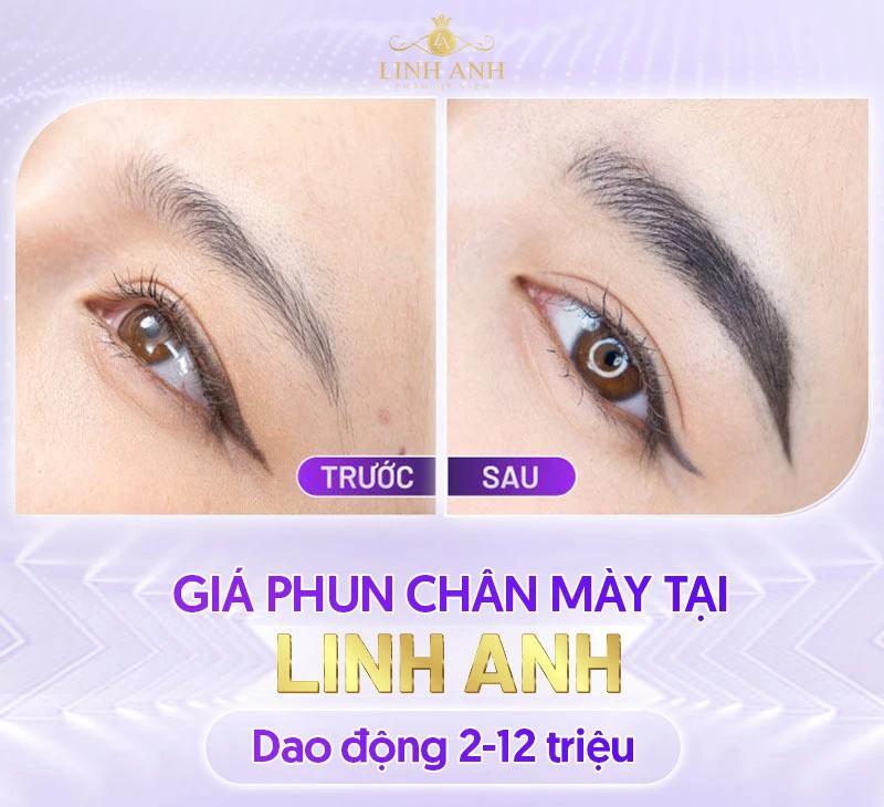 Bảng giá Thẩm mỹ viện Quốc tế Linh Anh cập nhật mới nhất