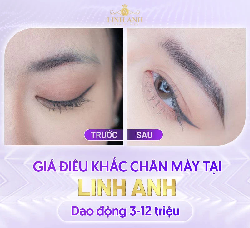 Bảng giá Thẩm mỹ viện Quốc tế Linh Anh cập nhật mới nhất