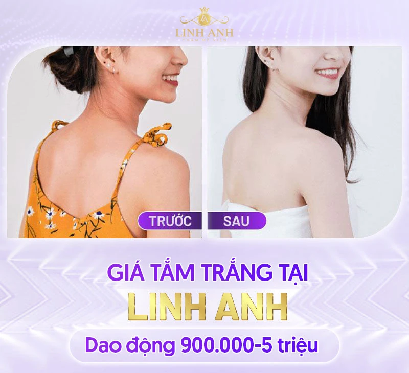 Bảng giá Thẩm mỹ viện Quốc tế Linh Anh cập nhật mới nhất