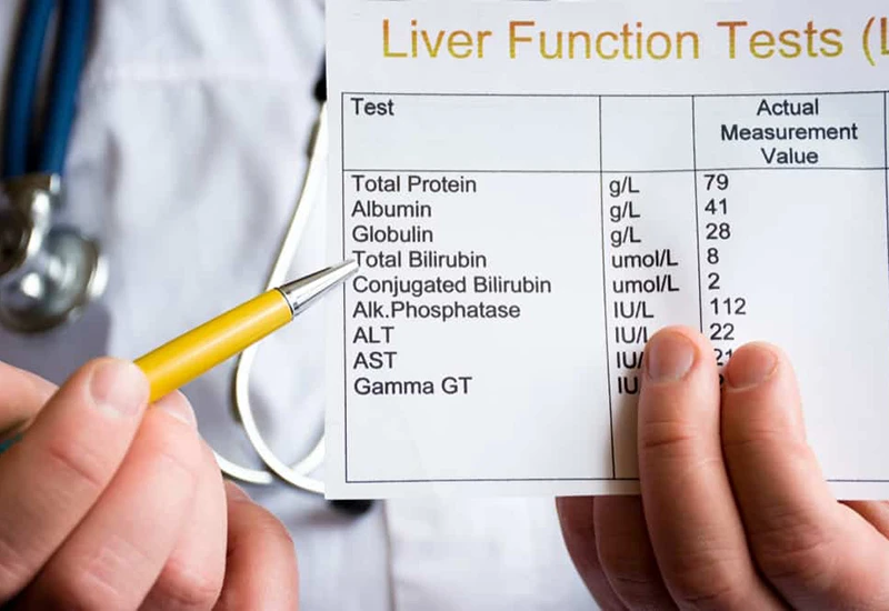 Bác sĩ hướng dẫn cách đọc chỉ số xét nghiệm gan