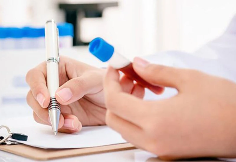 Bác sĩ hướng dẫn cách đọc chỉ số xét nghiệm gan