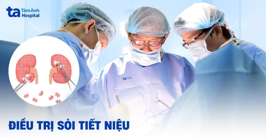 4 cách điều trị sỏi tiết niệu theo từng vị trí an toàn hiệu quả
