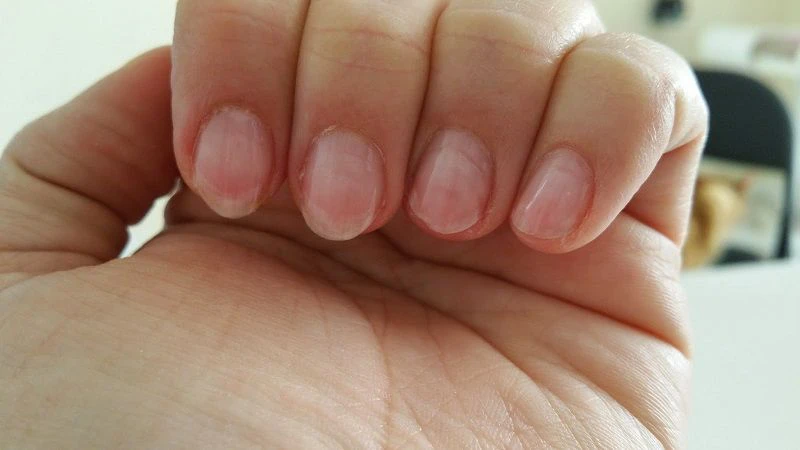 Cách làm móng tay nhanh dài trong 2 ngày tại nhà