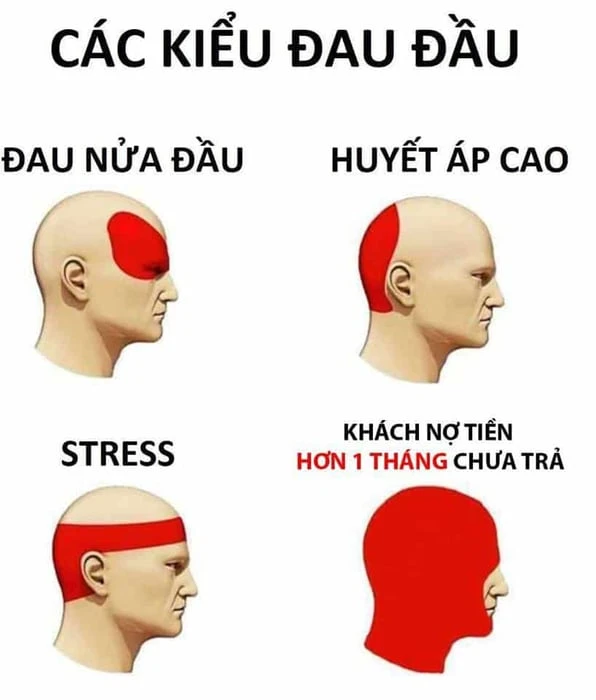 Nghệ thuật đòi nợ khéo