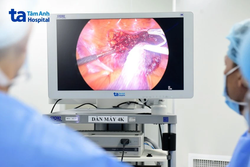 4 cách điều trị sỏi tiết niệu theo từng vị trí an toàn hiệu quả