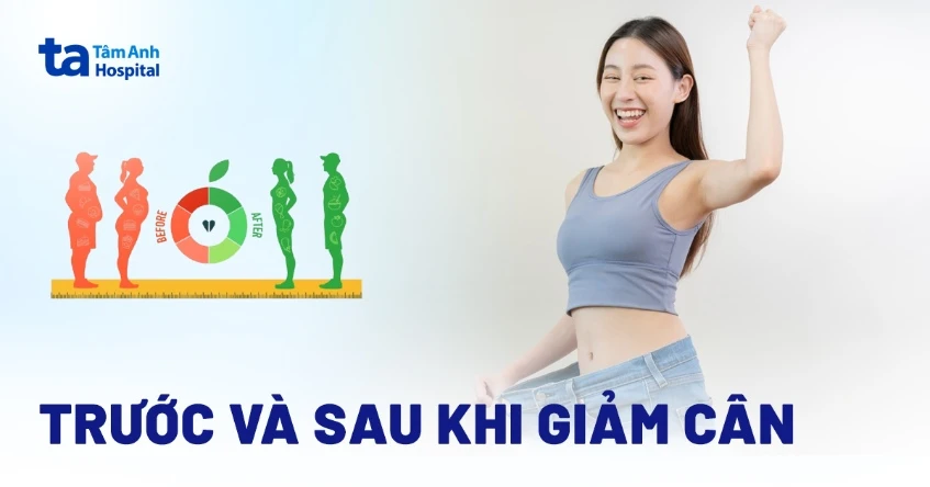 Hình ảnh trước và sau khi giảm cân: Quá trình thay đổi và duy trì
