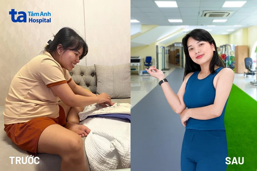 Hình ảnh trước và sau khi giảm cân: Quá trình thay đổi và duy trì