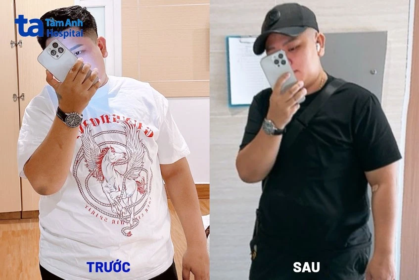 Hình ảnh trước và sau khi giảm cân: Quá trình thay đổi và duy trì